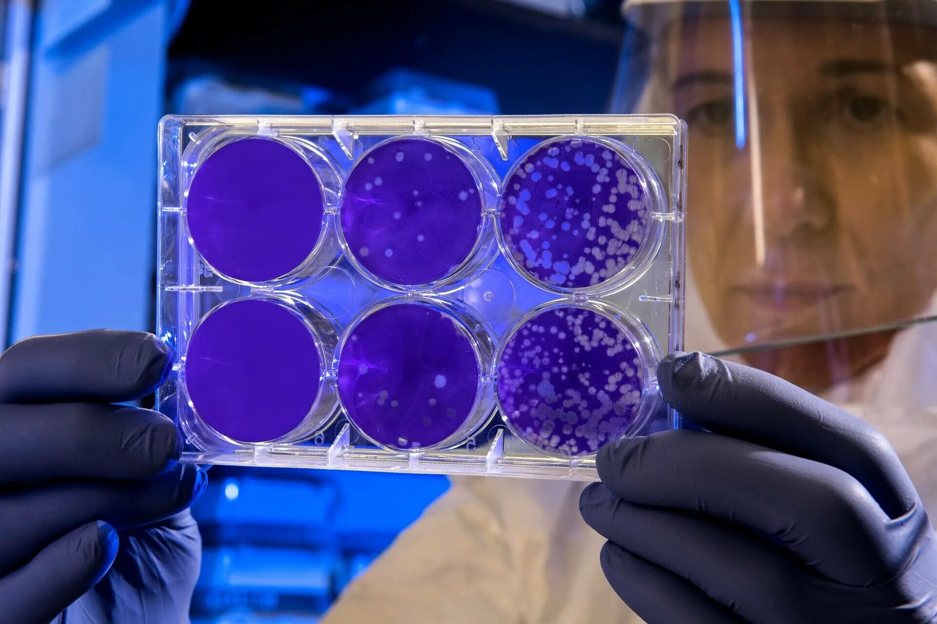 Ультрафиолет и бактерии. Пандемия это микробиология. Вирус ученый. Вирус лаборатория.