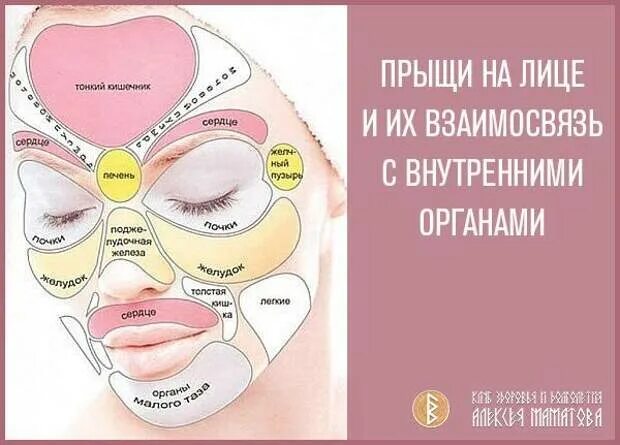 На подбородке прыщи что значит у женщин. Карта прыщей. карта прыщей на лице. схема прыщей на лице. прыщи на лице взаимосвязь.