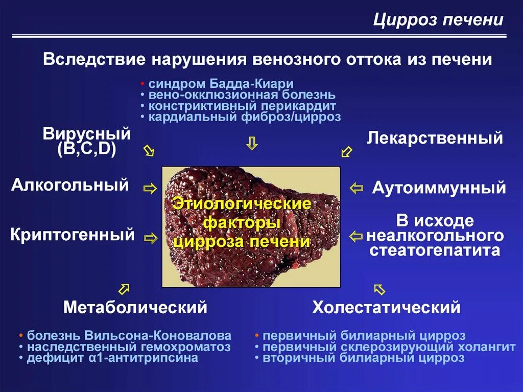 Симптомы лечения печени. Макронодулярный цирроз печени. Этапы формирования цирроза печени. Идиопатический цирроз печени. Криптогенный цирроз печени.