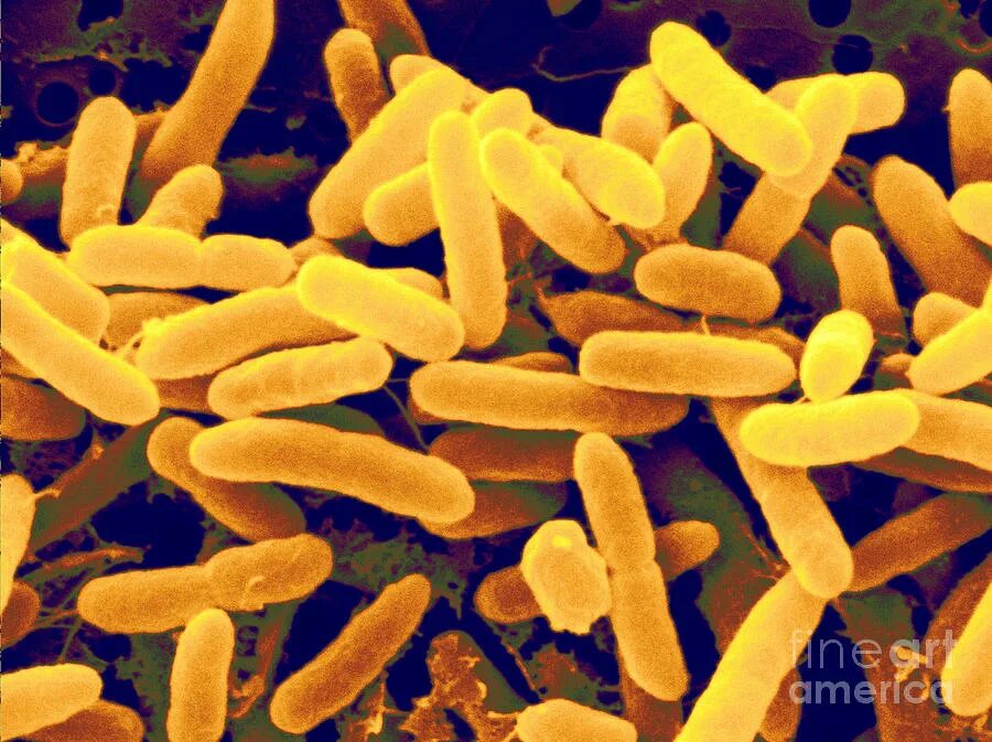 Pseudomonas spp что это. Pseudomonas aeruginosa. p.aeruginosa микробиология. микроорганизмы рода pseudomonas. бактерии pseudomonas.