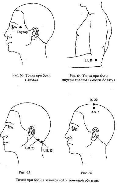 Болезненные точки на голове. Точки головной боли. Точки при головной боли. Точки от головной боли в затылке. Точки для массажа при боли в голове.