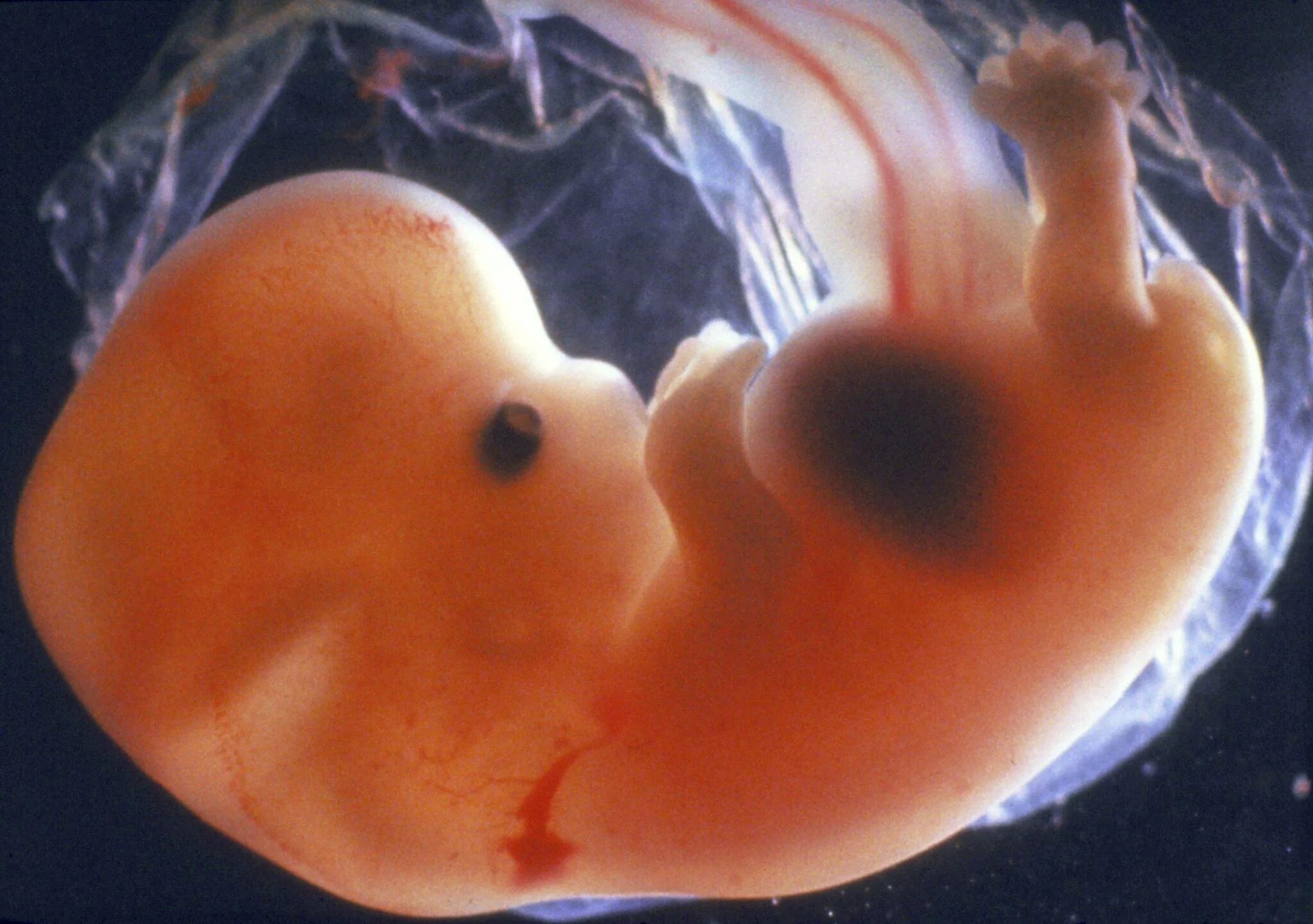 7 неделя беременности месячные. Эмбрион на 6 неделе беременности. Эмбрион на 7 неделе беременности. 5 6 Недель беременности фото эмбриона. Беременность 6 недель фото эмбриона.