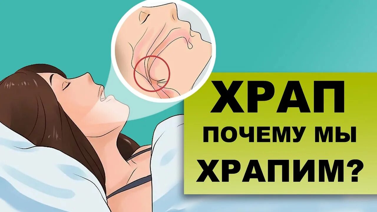 Почему люди храпят во сне как избавиться. Причины храпа. Лекарство для храпа. Как победить храп. Сильный храп у мужчин причины.