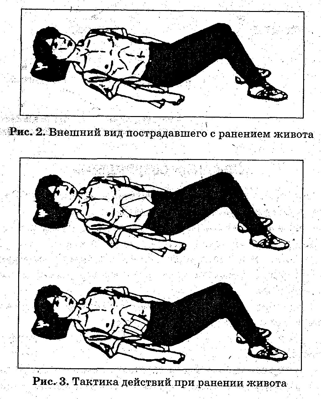 Ранение брюшной полости первая помощь. ПМП при ранении живота. Первая врачебная помощь при ранении брюшной полости. Можно ли пить пострадавшему при ранении живота