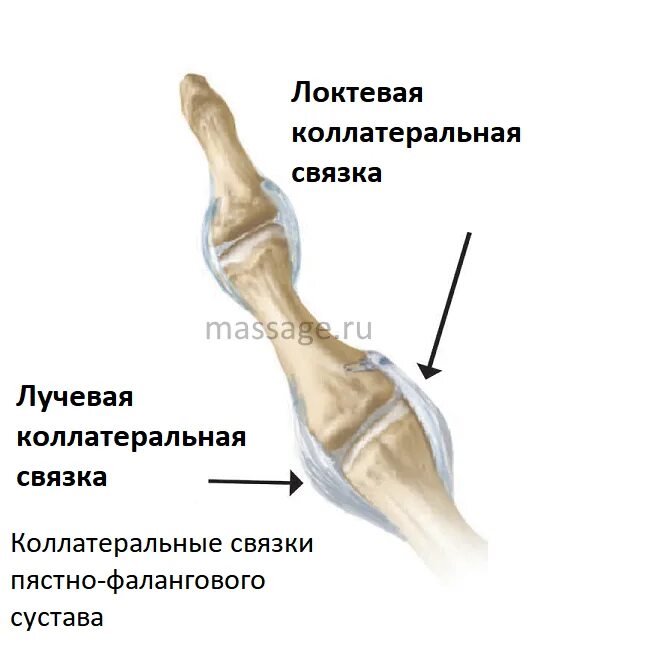 Порваны связки пальца руки. Разрыв связок пястно-фалангового сустава. повреждение связок пястно-фалангового сустава. 1 пястно-фаланговый сустав. разрыв локтевой коллатеральной связки запястья.