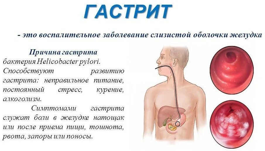 Почему стоит желудок. Болит желудок и тошнит причины.