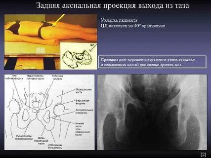 Проекция таза