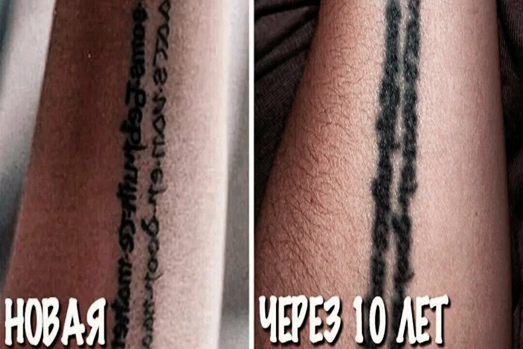Спустя пару месяцев после. Татуировки через несколько лет. тату спустя несколько лет. тонкие татуировки спустя год. тонкие тату спустя несколько лет.