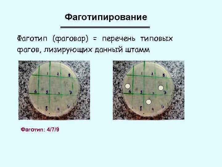 Фаготипирование это. Фаготипирование микробиология. фаготипирование культуры стафилококка. фаготипирование бактериофагов микробиология. фаготипирование цель методика микробиология.