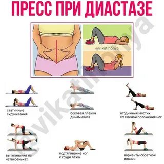 При пупочной грыже можно ли качать пресс