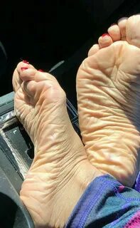 Wrinkled foot