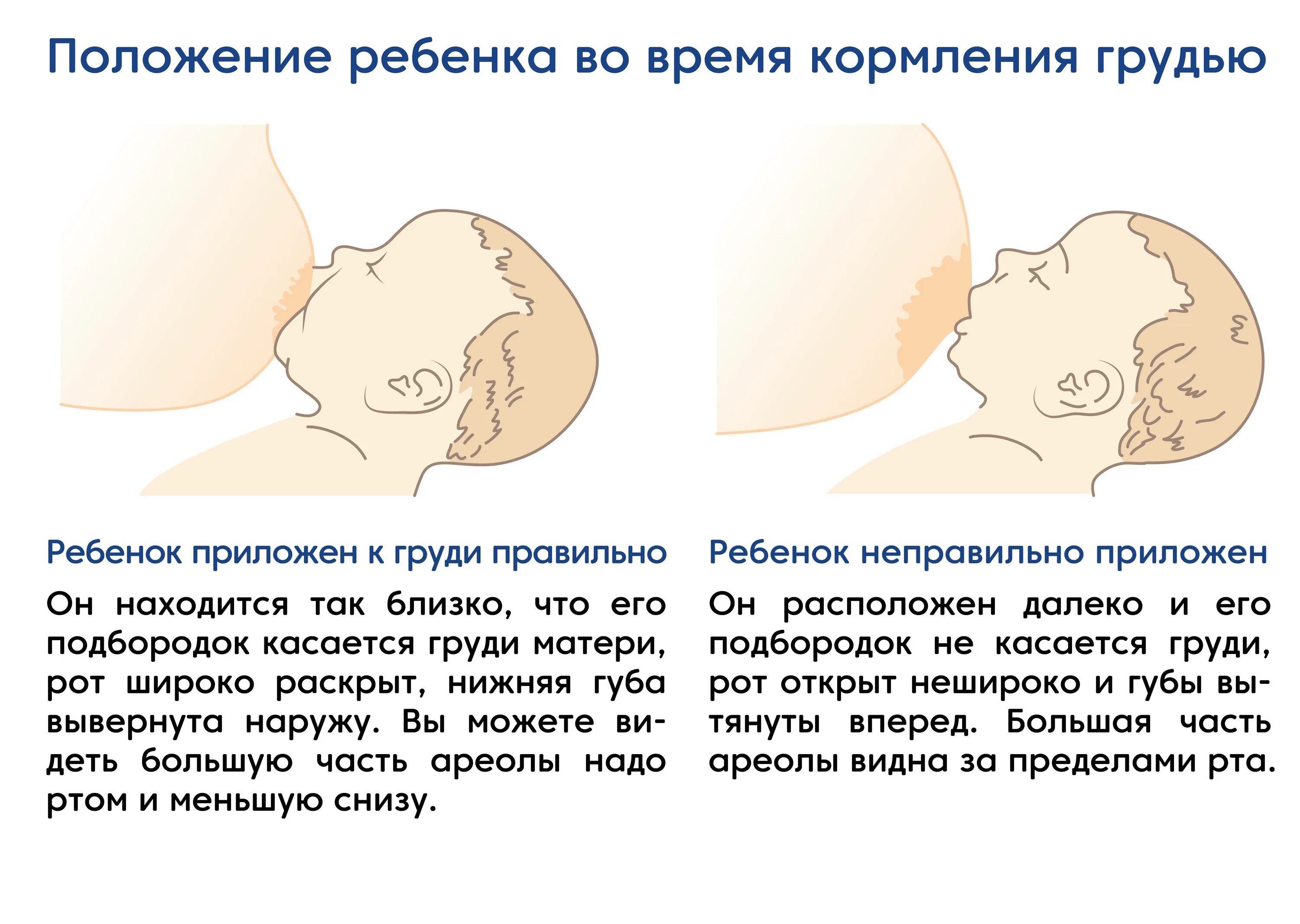 Положение ребенка при кормлении