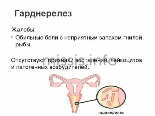 Запах рыбы у женщины лечить. Запах рыбы в интимной зоне. неприятный запах из интимной зоны. неприятный запах из влагалища. запах из влагалища неприятный причина.
