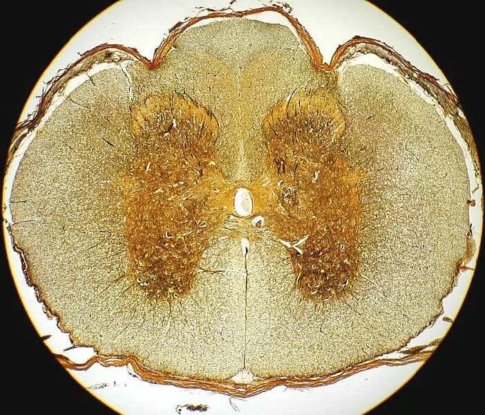 Срез психология. Срез спинного мозга гистология. Поперечный срез спинного мозга импрегнация серебром. Строение спинного мозга гистология. Серое вещество спинного мозга гистология препарат.