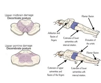 Pin by 敏 雄 陳 on Ideas for the House Neurological assessment, Critical care, Medi