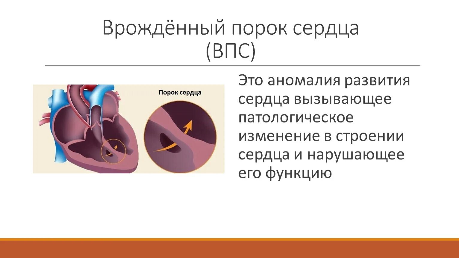 Пороки сердца классификация врожденные и приобретенные. Врожденные и приобретенные пороки сердца кратко. Клинические проявления приобретенные митральные пороки сердца. Врожденный порокb сердца.