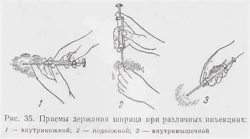 Как держать иглу. Техника введения внутримышечных инъекции у КРС. Внутримышечный укол собаке схема. Введение иглы при внутрикожной инъекции.