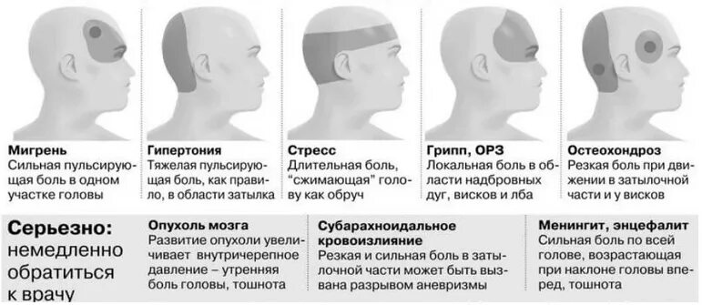 Почему обносит голову и кажется что упадешь. Головная боль локализация. Болит задняя часть головы затылок.