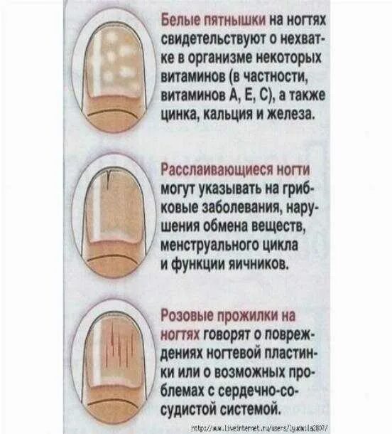 Пути устал ногти. На правом указательном пальце белое пятно на ногте что это такое. Белые пятна на безымянном пальце на левой руке. Белые ногти пальцев рук приметы. Белые ногти пальцев рук приметы.