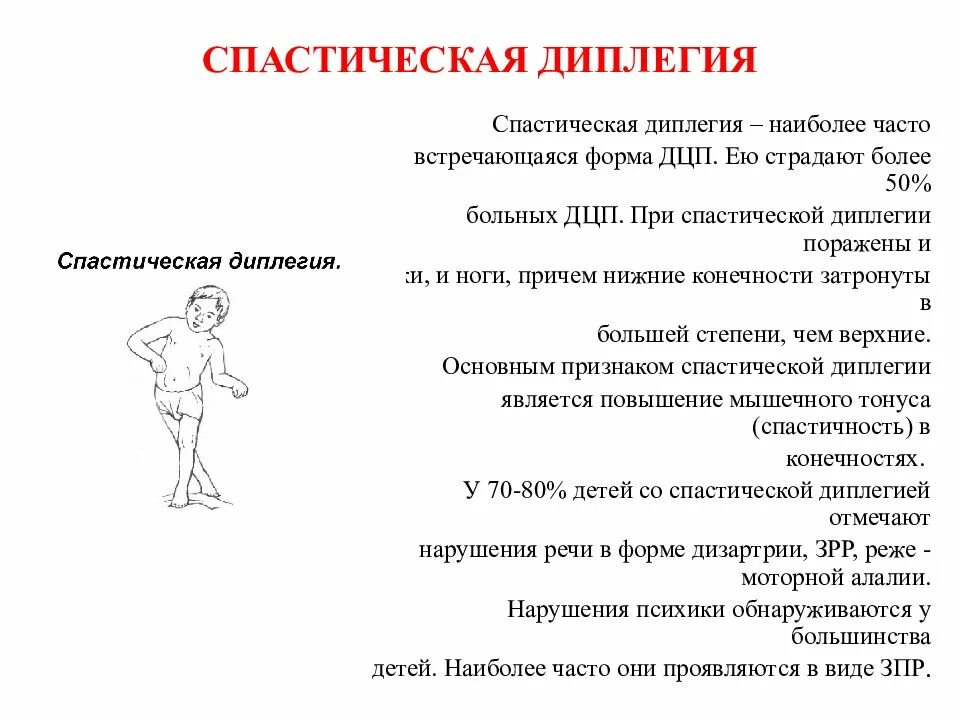 Стадии дцп. Спастическая форма ДЦП тонический рефлекс. Спастическая форма ДЦП характеристика. Спастическая диплегия (синдром Литтля). Спастическая диплегия форма ДЦП.