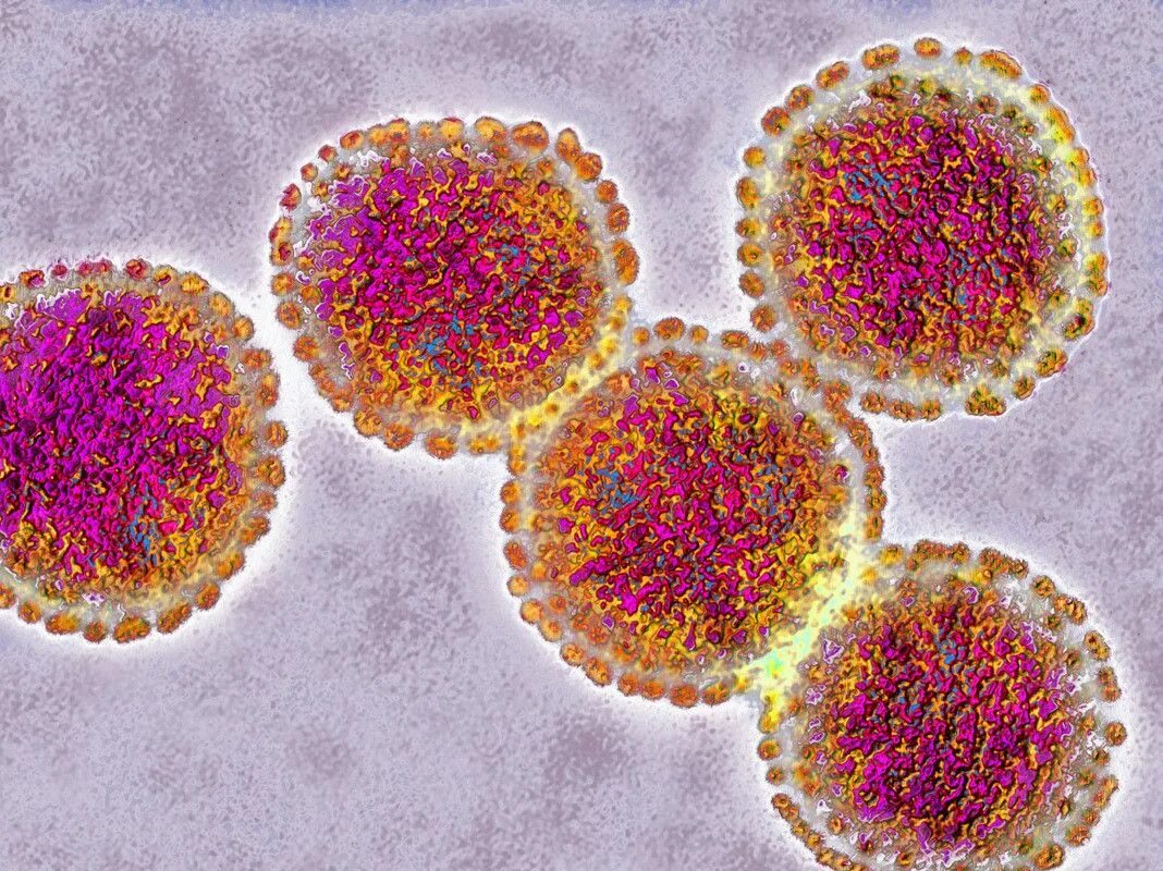 Вирус свиного гриппа (h1n1). Вирус h1n1 испанка. Вирус h1n1 под микроскопом. Грипп h5n1. Грипп номер 1