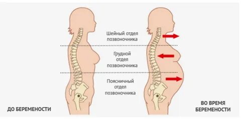 Беременность болит поясница и копчик