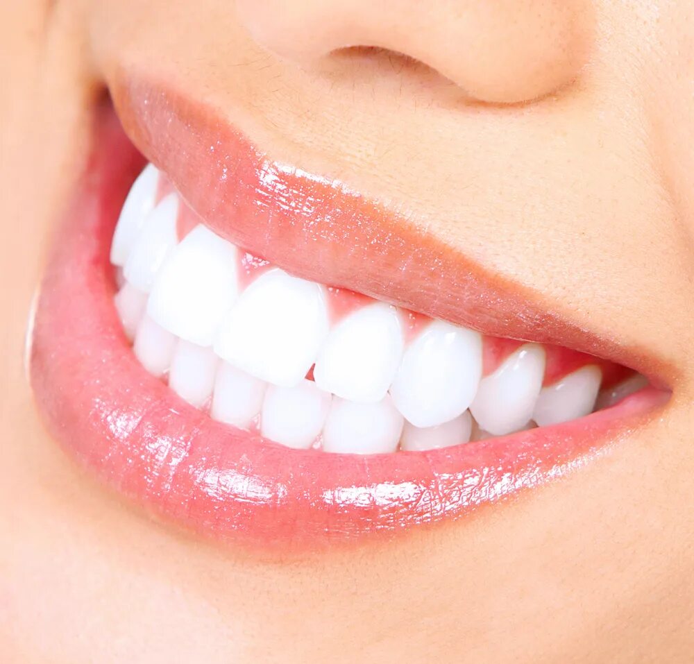 Аккуратнее зубы. Красивые зубы. Ровные зубы. Идеальные зубы. Белые зубы.