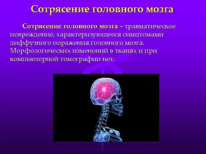 Сотрясение 3. Сотрясение головного мозга патанатомия. Травматические поражения головного мозга. Морфологические изменения мозга при сотрясении. Патологическая анатомия сотрясения головного мозга.