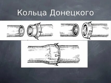 Механический сосуд