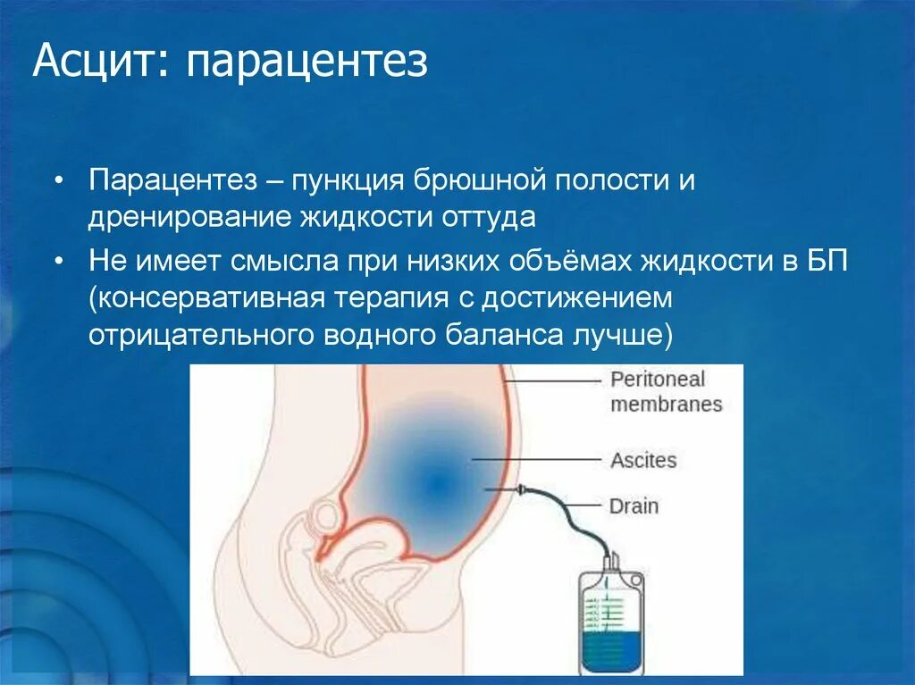 Почему при откачивании воздуха вода. Жидкость из брюшной полости. Жидкость в брюшной полости (асцит). Асцит это скопление жидкости в.