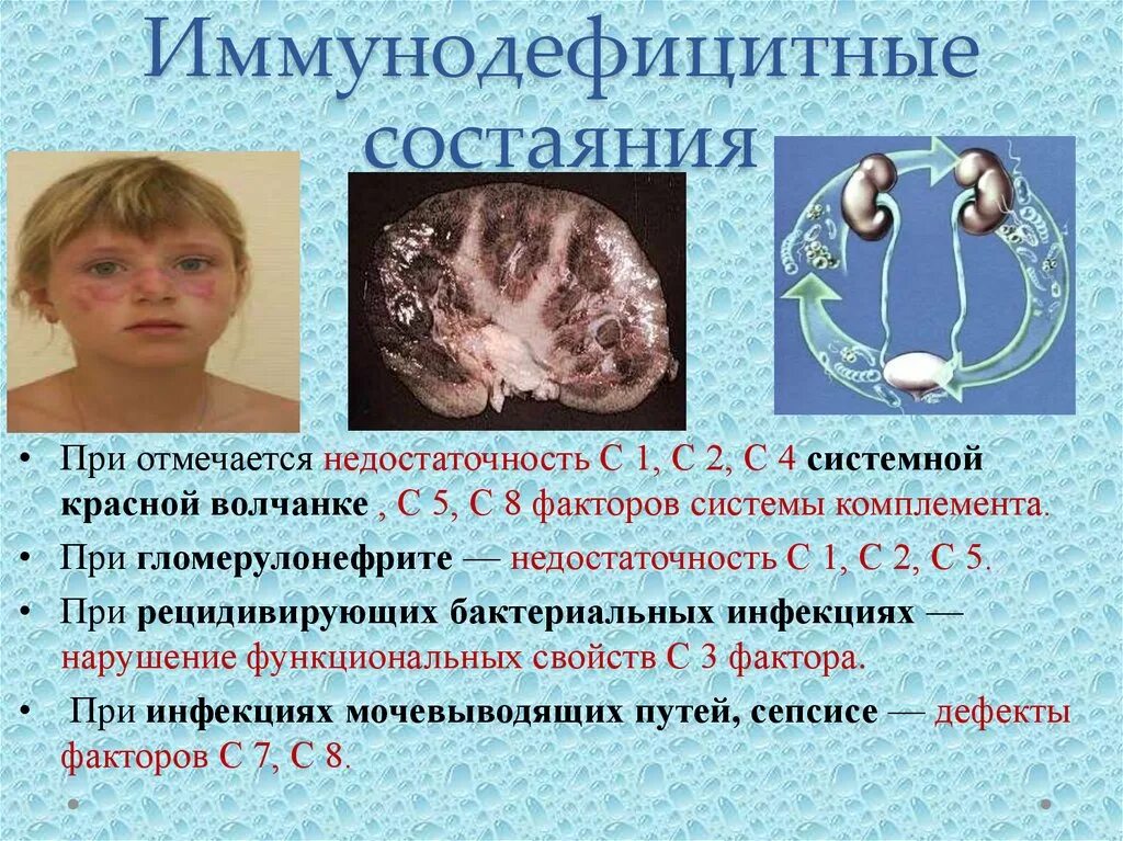 Иммунодефицитные состояния. Иммунодефицитные состояния презентация. Первичный иммунодефицит у детей. Врожденные иммунодефициты.