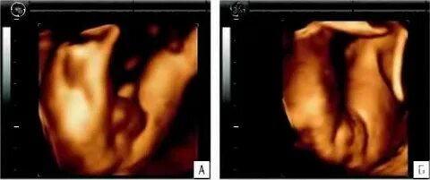 Эротикалық порно фотоларды көрсетіңіз