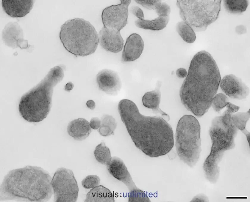 Chlamydia trachomatis mycoplasma genitalium. Микоплазмоз микроскопия. Mycoplasma genitalium микроскопия.