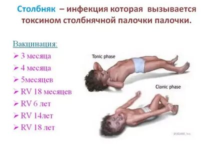 Столбняк инфекции