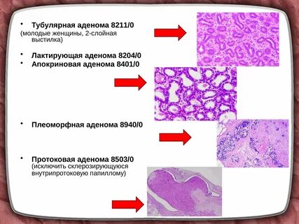 Пролиферация промежуточного эпителия
