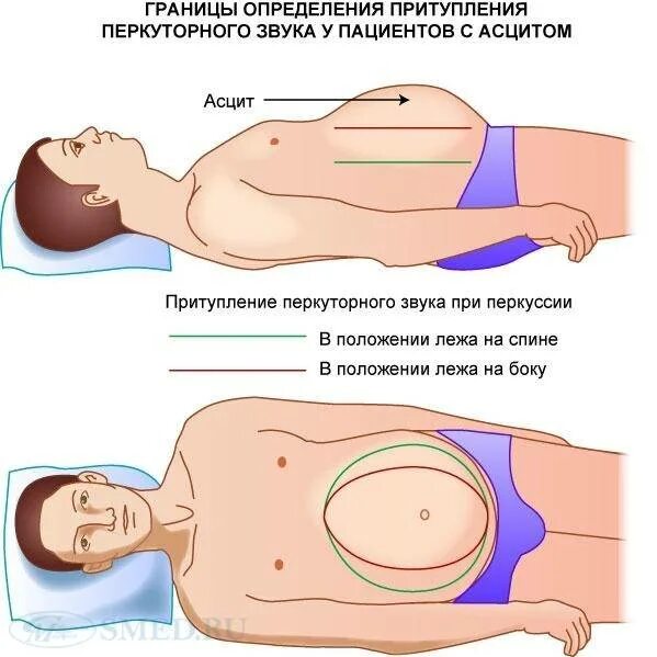 Температура в лежачем положении