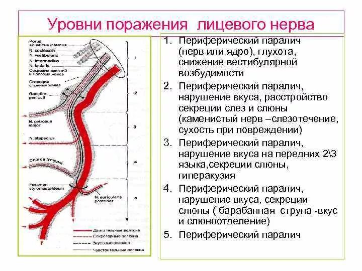 Порез лицевого. Лицевой нерв неврология уровни поражения. Уровень поражения 7 нерва. Поражение лицевого нерва неврология. Симптомы поражения лицевого нерва неврология.