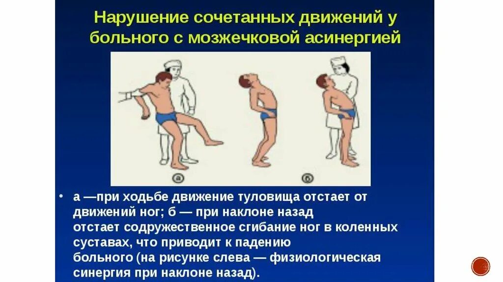 Варианты нарушения движения. Походка при поражении мозжечка. нарушение движения. содружественные движения в конечностях. нарушение походки при поражении мозжечка.