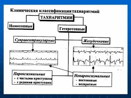 Нарушение ритма клинические рекомендации 2020