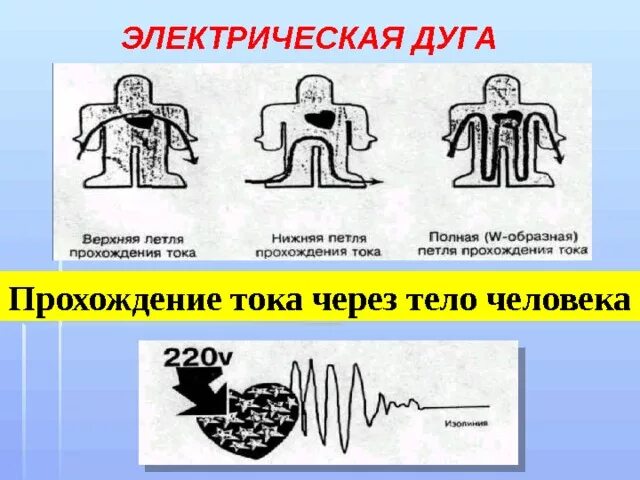 Какие петли тока наиболее опасны. Воздействие электрической дуги на организм человека. Последствия электрической дуги. Пути прохождения тока. Электрическая дуга.