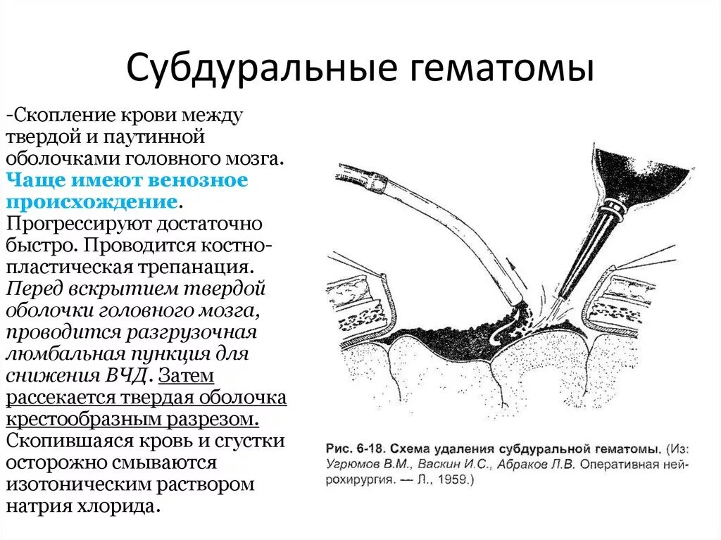 Осуществление пункции подкожной гематомы.. Костно-пластическая Трепанация. Удаление субдуральной гематомы. Осуществление пункции подкожной гематомы алгоритм. Гематома мозга операция