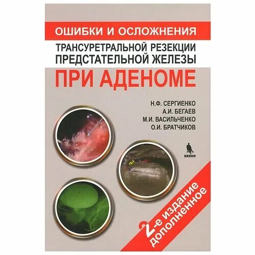 Простат аденом отзывы. Осложнения трансуретральной резекции. осложнения предстательной железы. трансуретральная резекция простаты осложнения. аденома простаты лекарства.