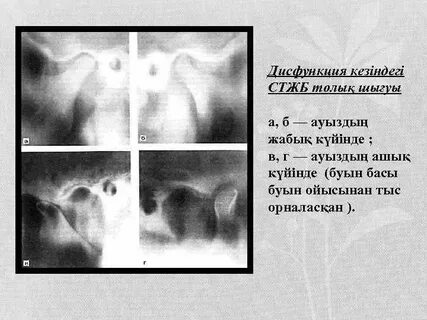 Топтық порнодағы Рокко