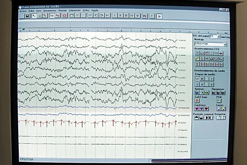 узи, экг, ээг. энцефалограмма. ээг детям. энцефалограмма адреса.