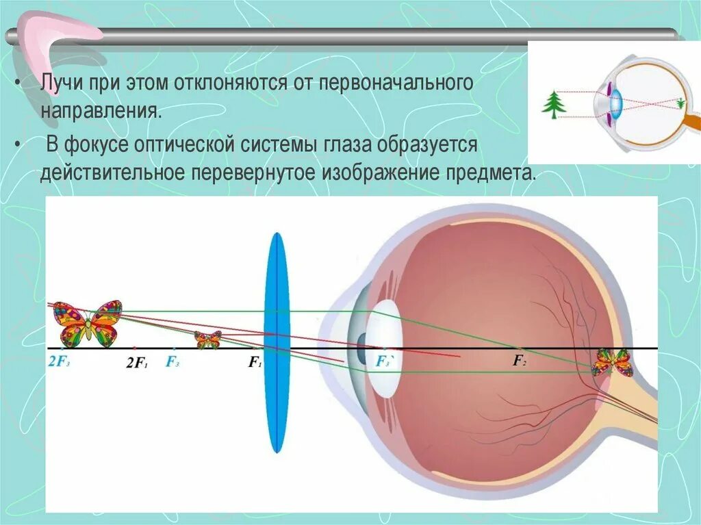 Глаз имеет оптическую силу. Аккомодация зрения механизм. Механизм аккомодации хрусталика. Аккомодация глазного яблока. Рефракция и аккомодация глаза.