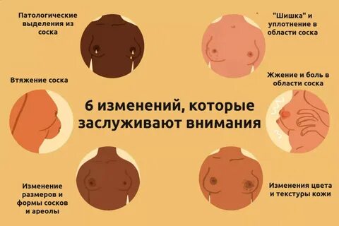 Ареола фотосы