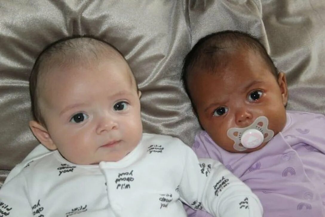 Родился в англии. Близняшки с разным цветом кожи. Дети двойняшки. Двойняшки с разным цветом кожи. Разноцветные Близнецы.