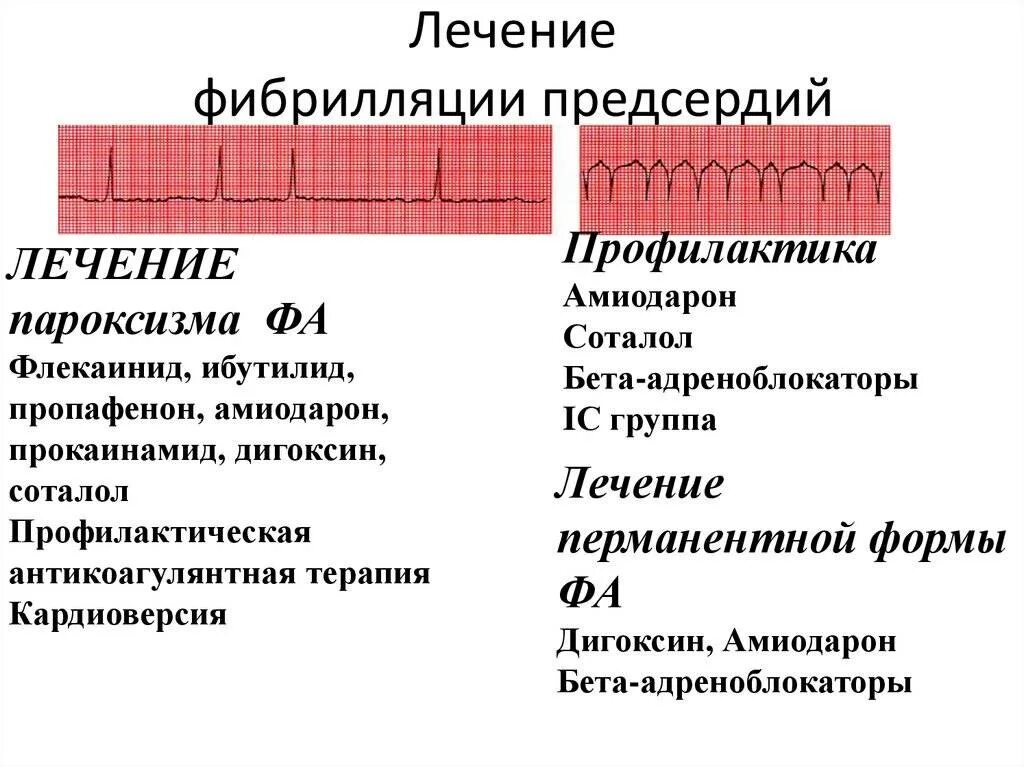 Фибрилляция предсердий пароксизмальная форма. Принципы терапии фибрилляции предсердий. пароксизмальная форма фибрилляции предсердий. клинические формы фибрилляции предсердий. экг при персистирующей форме фибрилляции предсердий.