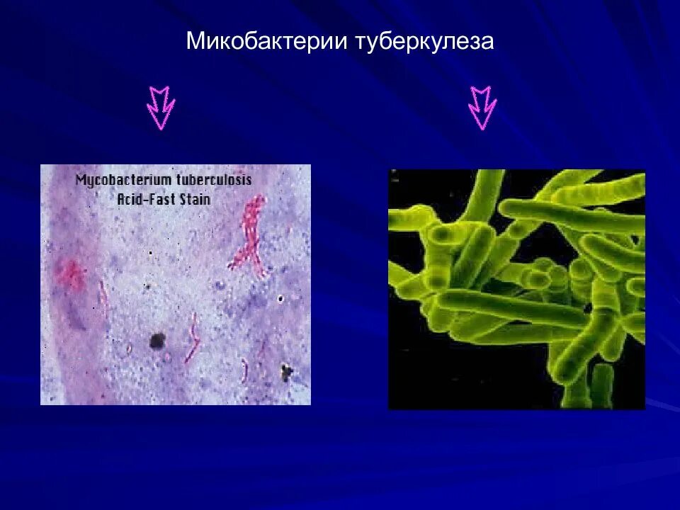 Корд-фактор микобактерий туберкулеза. Бактерия Mycobacterium tuberculosis. Микобактерии туберкулеза микробиология. Микобактерия туберкулеза анаэроб.