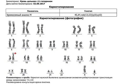 Расшифровка кариотипа
